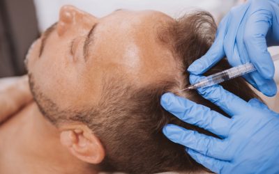 What is Regenerative Hair Growth?